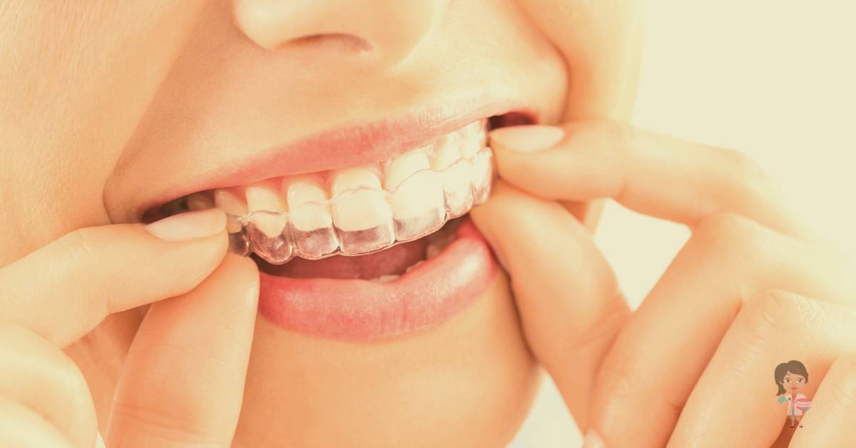 How Many Invisalign Trays Do I Need To Fix My Teeth? [year]